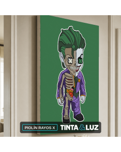 PIOLÍN RAYOS X